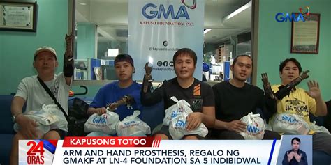 5 individuals receive arm, hand prostheses through GMA Kapuso .